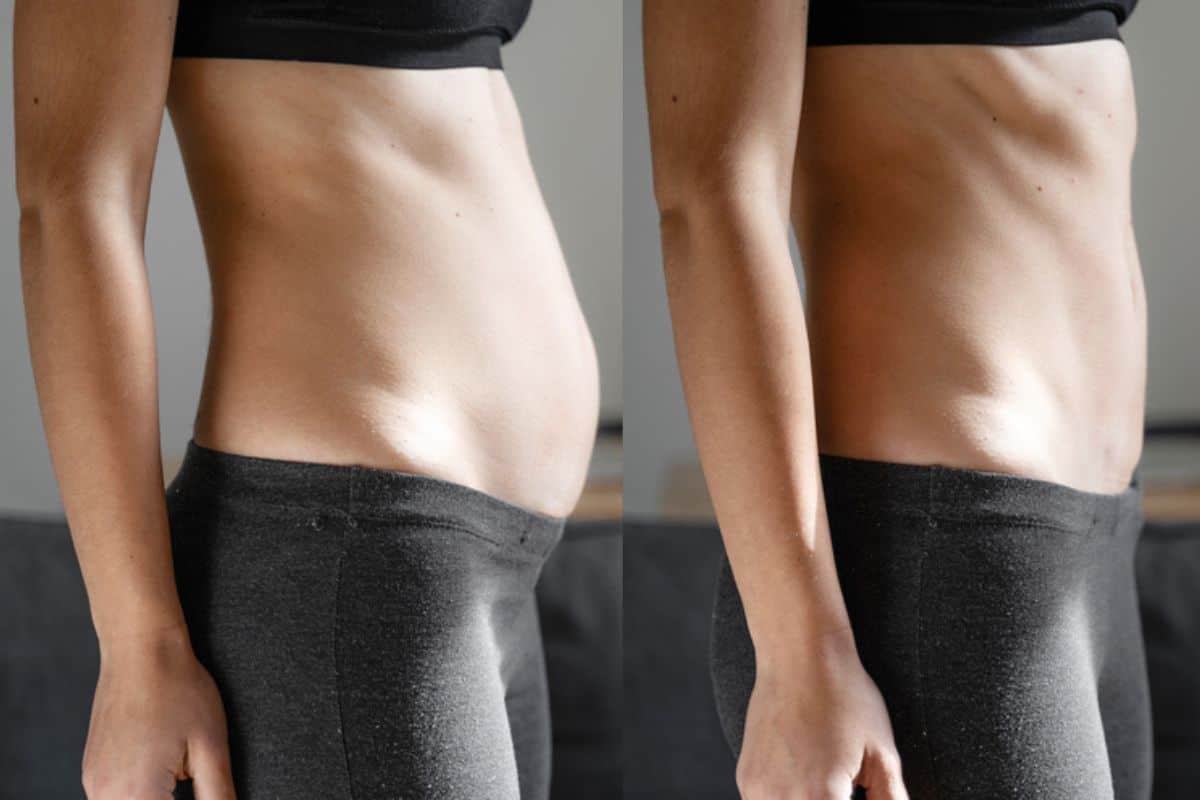 Post-Pregnancy: What Happens to Your Abdominal Muscles After Birth Wheathampstead