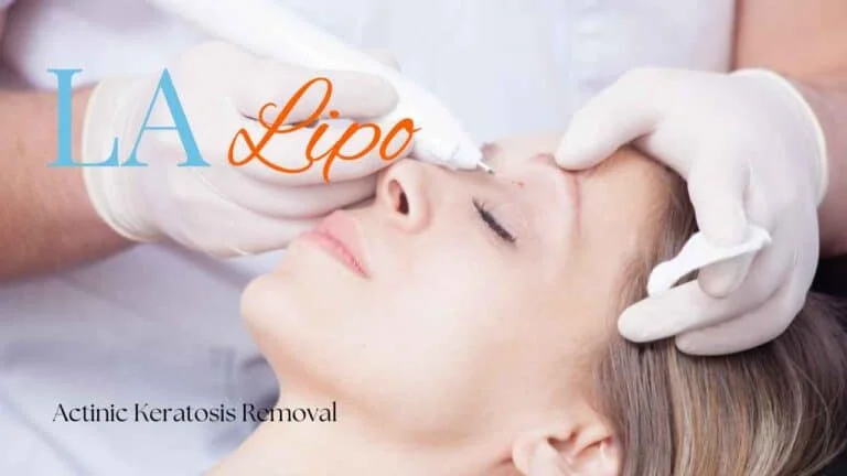 Woman receiving Actinic Keratosis Removal Treatment Wheathampstead