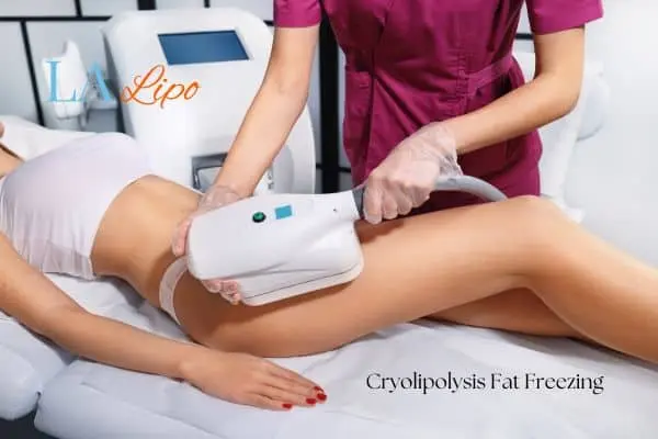 Woman receiving coolsculpting Wheathampstead treatment on her thighs