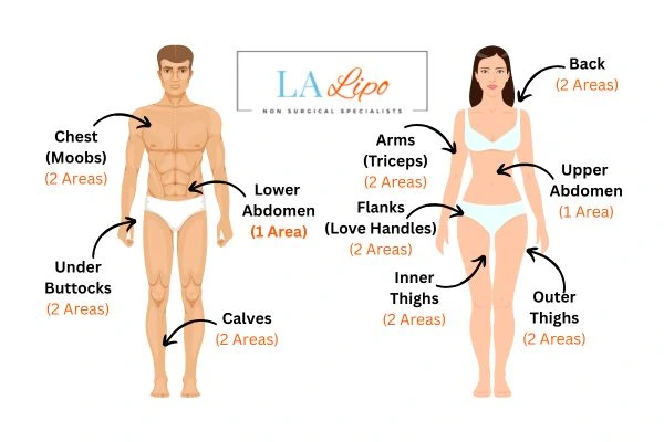 LA LIPO Cryolipolysis Areas Wheathampstead