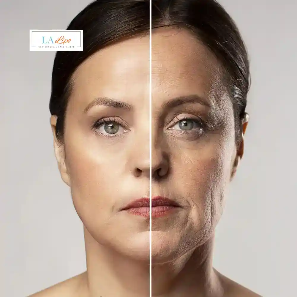 How Can You Tell If Non-Surgical Skin Tightening Is Right for You Wheathampstead?