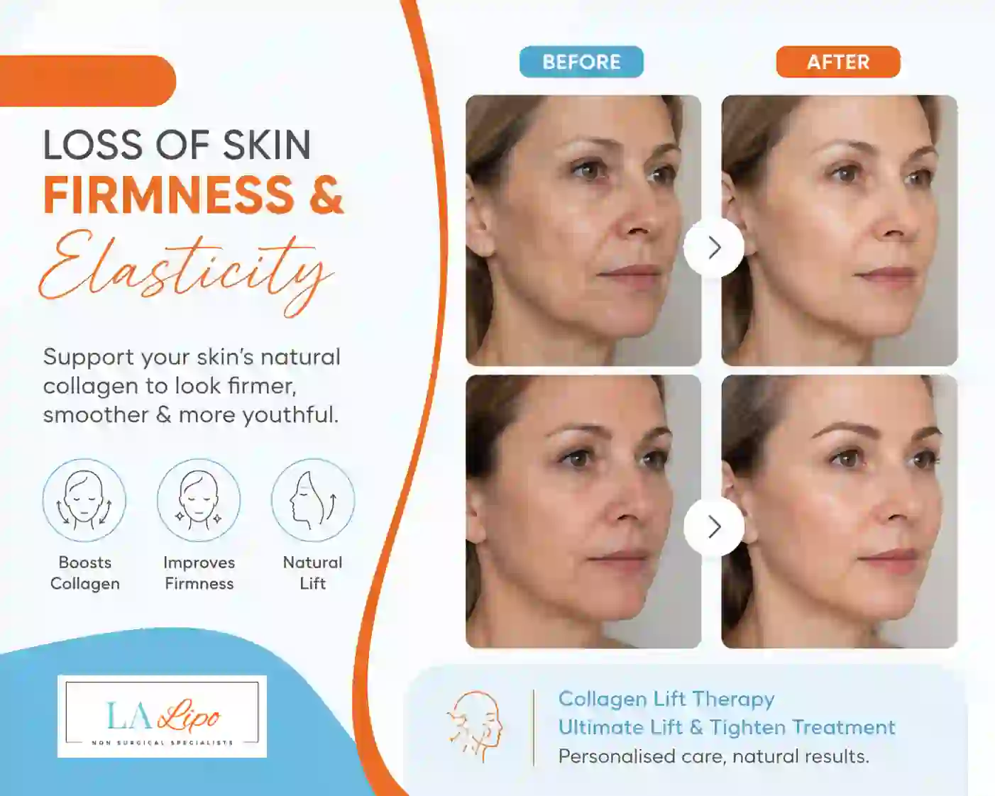 Sign #7: Loss of Skin Firmness and Elasticity Wheathampstead