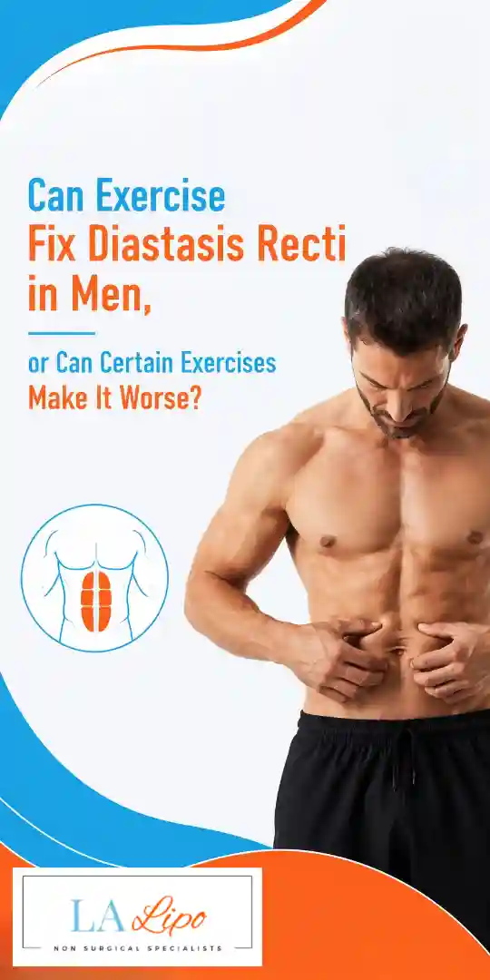 Can Exercise Fix Diastasis Recti in Men, or Can Certain Exercises Make It Worse Wheathampstead?